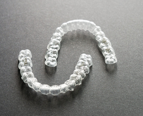 tipos de férulas dentales