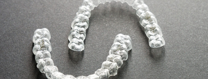 tipos de férulas dentales