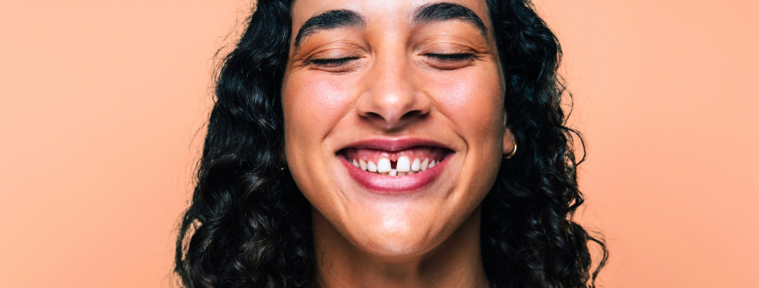 Diastema dental