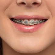 brackets en casos complejos
