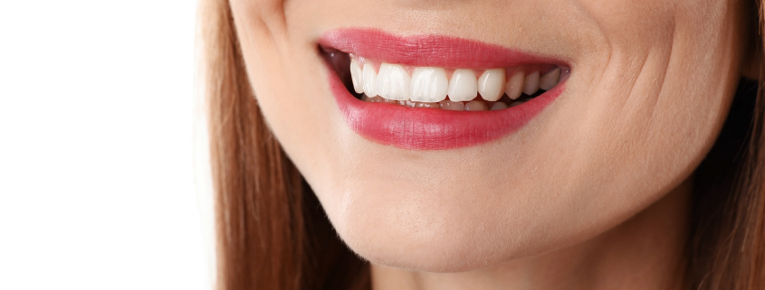 duelen los implantes dentales